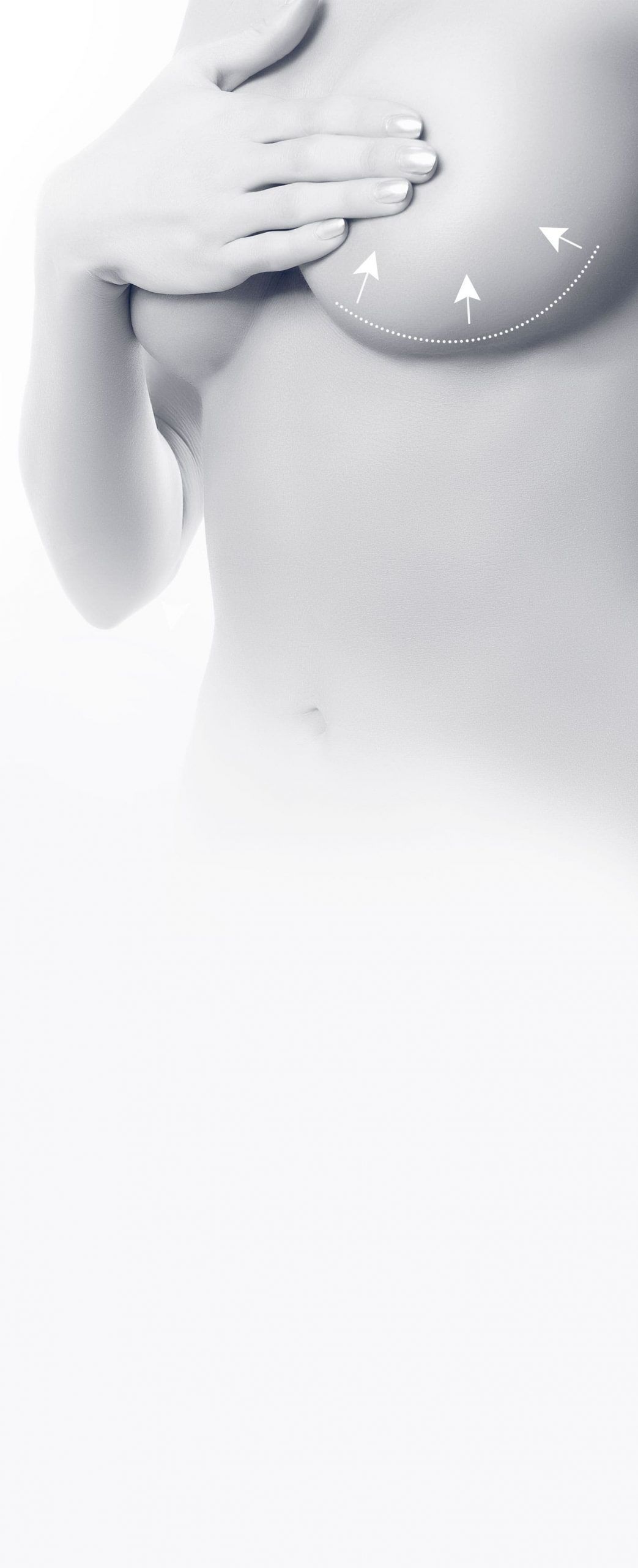 Réduction mammaire - Diminution du volume des seins à Cannes - Dr Laveaux